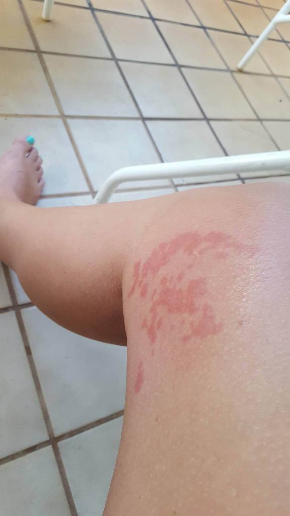 received_10101548960458188